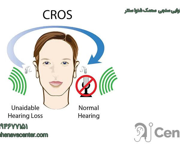 سمعک کراس (cros)