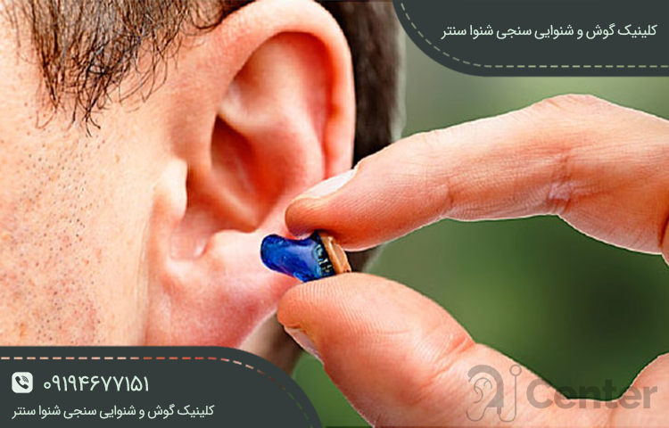 بهترین ویژگی‌های سمعک‌های داخل گوشی