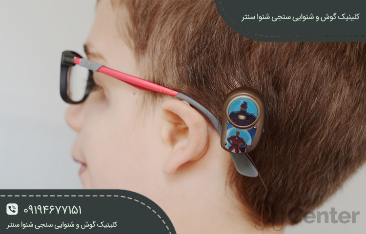 انواع سمعک استخوانی