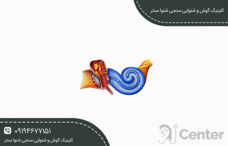 عفونت گوش داخلی