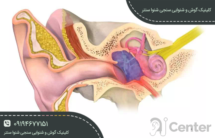 اتواسکلروز (Otosclerosis) چیست؟