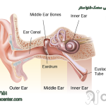 کلستئاتوم یا کیست گوش میانی چیست