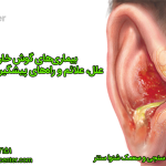 بیماری‌های گوش خارجی:علل، علائم و راه‌های پیشگیری در زنجان