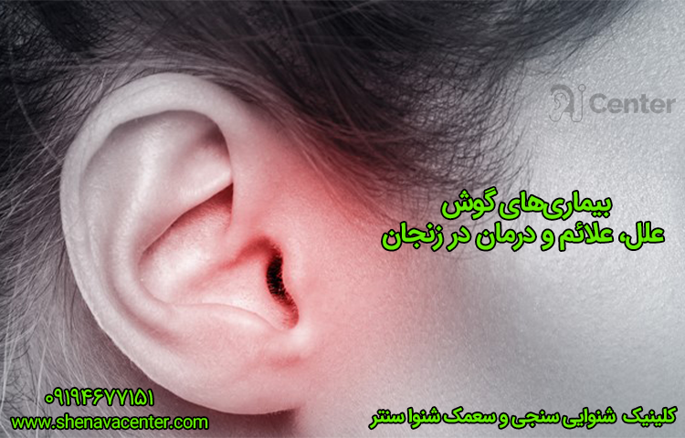 بیماری‌های گوش؛ علل، علائم و درمان در زنجان