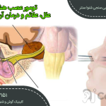 تومور عصب هشتم در زنجان