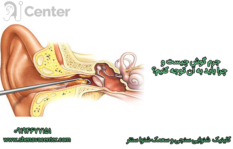 جرم گوش چیست و چرا باید به آن توجه کنیم؟