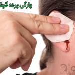 پارگی پرده گوش زنجان